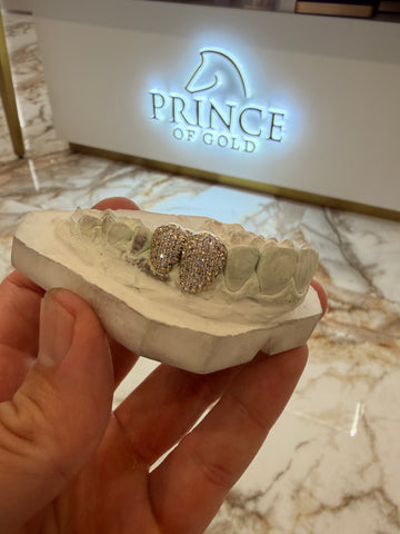 Iced out 2 teeth Grillz